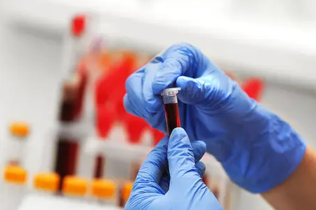 BABIO Fluorescence Bovine Pregnancy Rapid Test ஐ அறிமுகப்படுத்துகிறது