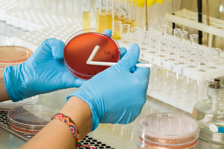 BABIO's MacConkey Agar மீடியம் - உலகளாவிய நுண்ணுயிரியல் கண்டறிதலுக்கான பிரீமியம் தேர்ந்தெடுக்கப்பட்ட தனிமைப்படுத்தல்